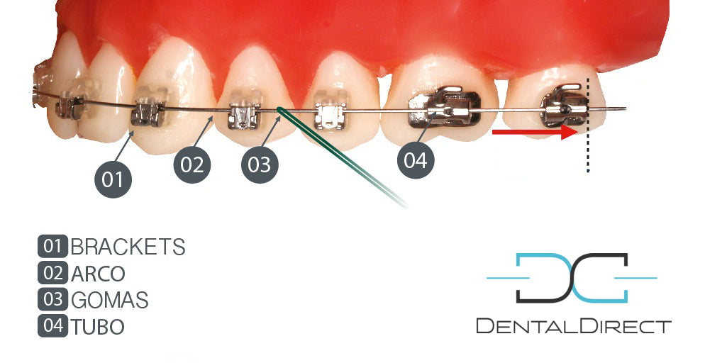 Los arcos dentales en Ortodoncia