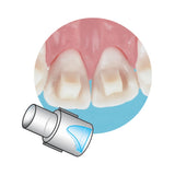 Reposiciones mini moldes ortodoncia Mini Mold Sia Orthodontics