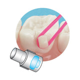 Reposiciones Mini Mold Button Sia Orthodontics FC-MM03