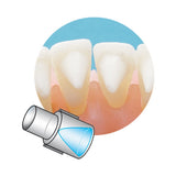 Reposiciones Mini Mold Habit Sia Orthodontics FC-MM04