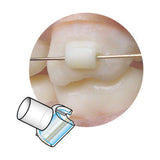 Reposiciones Mini Mold Tube Sia Orthodontics FC-MM06