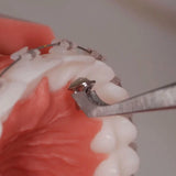 Overbite Corrrector BT2  SIA Orthodontic